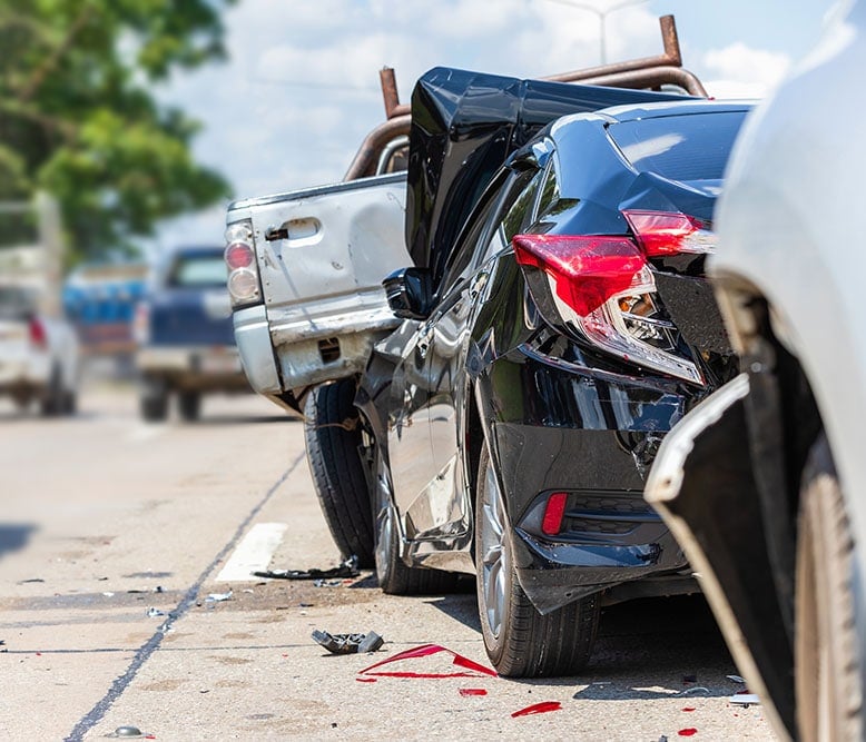 Car Accident Injury Lawyers